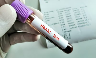 Close-up of gloved hand holding vial marked HbA1C-Test